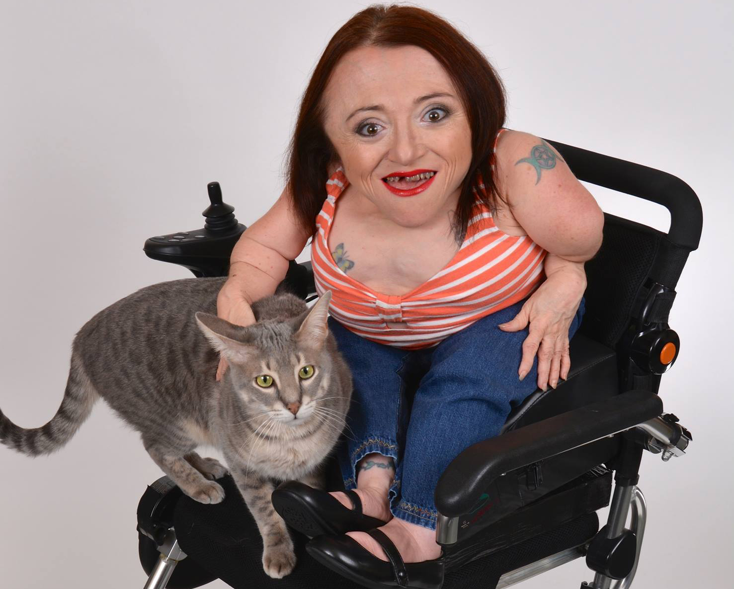 “Hashing It Out” with Jane Hash: An Activist With Osteogenesis Imperfecta